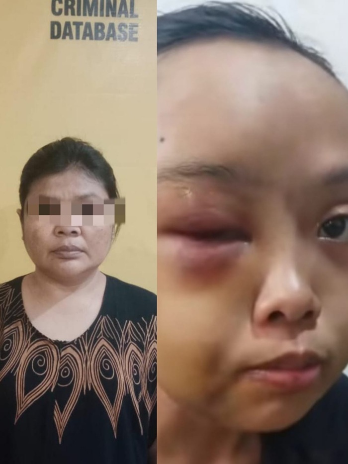 Gadis Yatim Dipijak dan Dipukul Tantenya Hingga Babak Belur di Perumahan Teratai Jaya, Masuk Bui Deh.!!